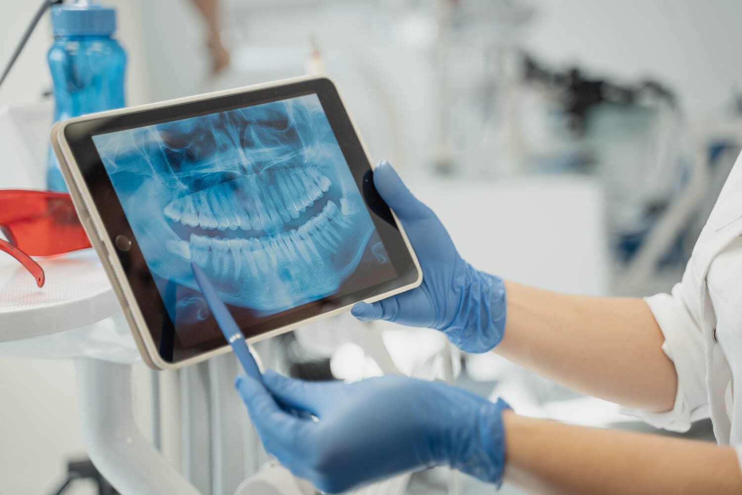 Tooth Extraction Preparation X-ray